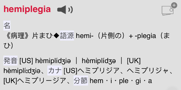ダブリナーズ_ジェイムズ・ジョイス_hemiplegia 半身不随